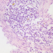 TS-20180930112436351-1920