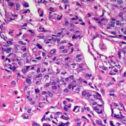 TS-20181018104849759-1920